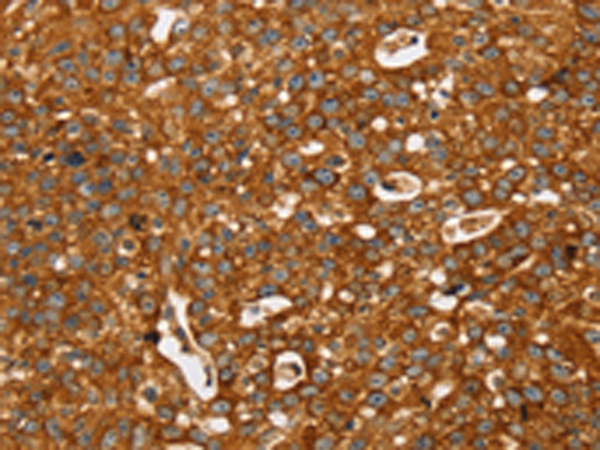 Rabbit Polyclonal Antibody to STK32A