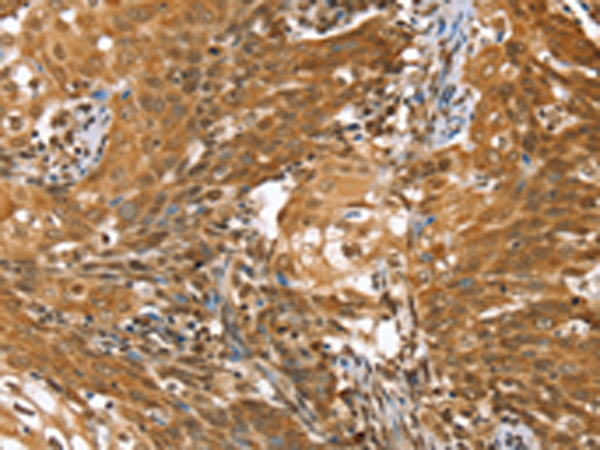 Rabbit Polyclonal Antibody to STK32B