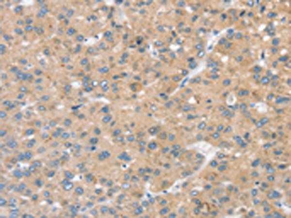 Rabbit Polyclonal Antibody to STK32C