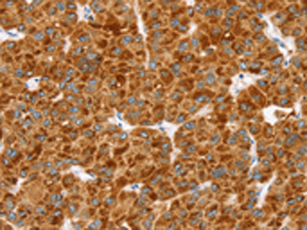 Rabbit Polyclonal Antibody to MGST1