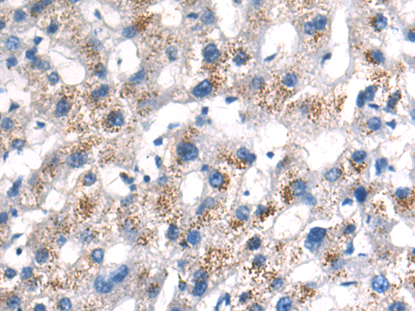Rabbit Polyclonal Antibody to SULF1