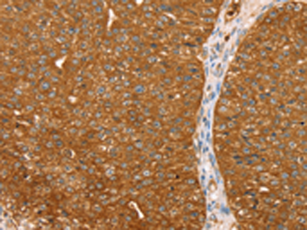 Rabbit Polyclonal Antibody to ABCC8