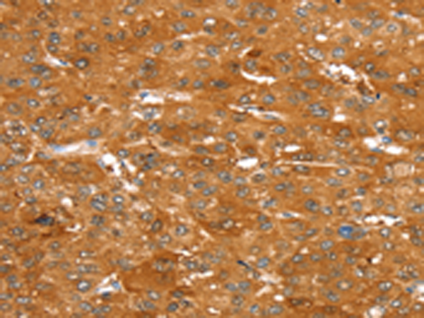 Rabbit Polyclonal Antibody to ABCC9