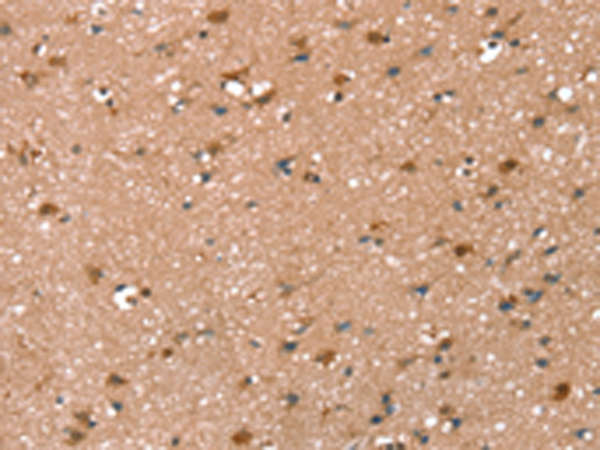 Rabbit Polyclonal Antibody to SYNPO2