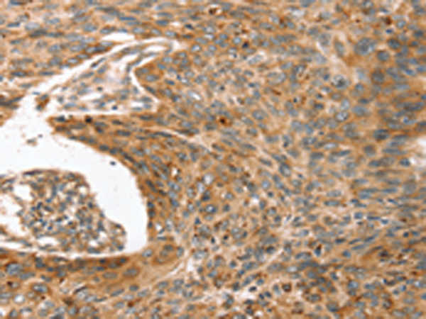 Rabbit Polyclonal Antibody to ERVW-1