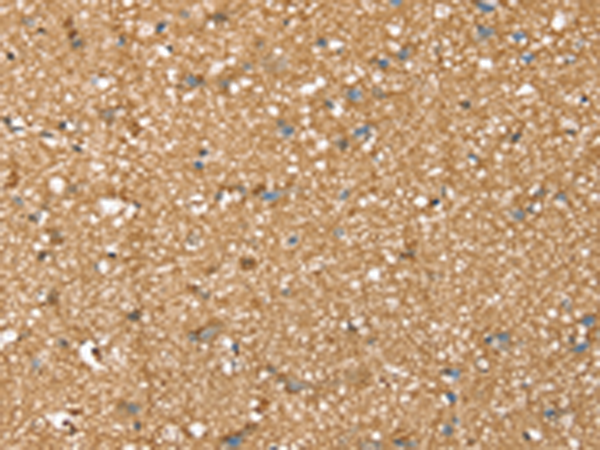 Rabbit Polyclonal Antibody to SDC3