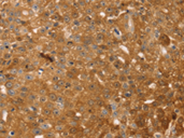 Rabbit Polyclonal Antibody to TMSB10