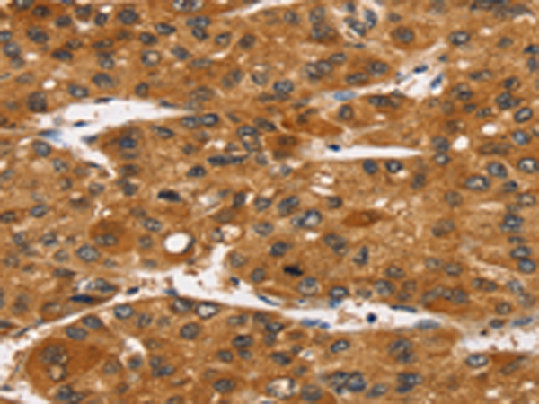 Rabbit Polyclonal Antibody to TACC2