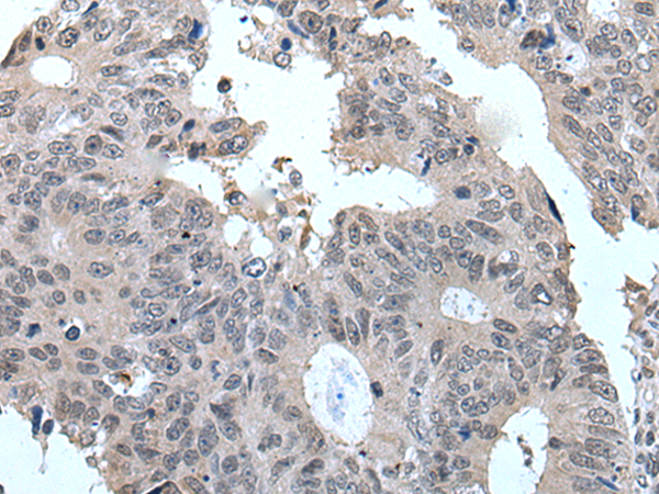 Rabbit Polyclonal Antibody to TBX1