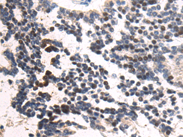 Rabbit Polyclonal Antibody to ELOA2
