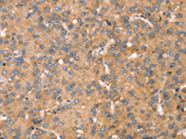Rabbit Polyclonal Antibody to TGFB2
