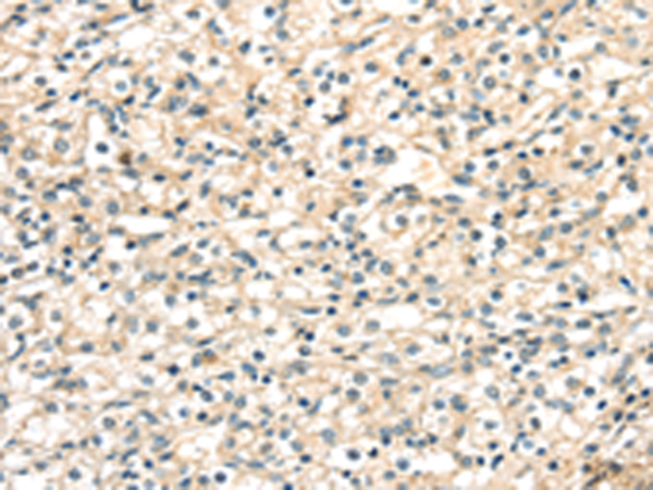 Rabbit Polyclonal Antibody to TGM4