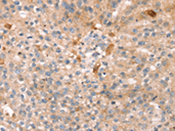 Rabbit Polyclonal Antibody to THAP9