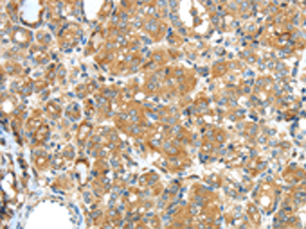 Rabbit Polyclonal Antibody to F2
