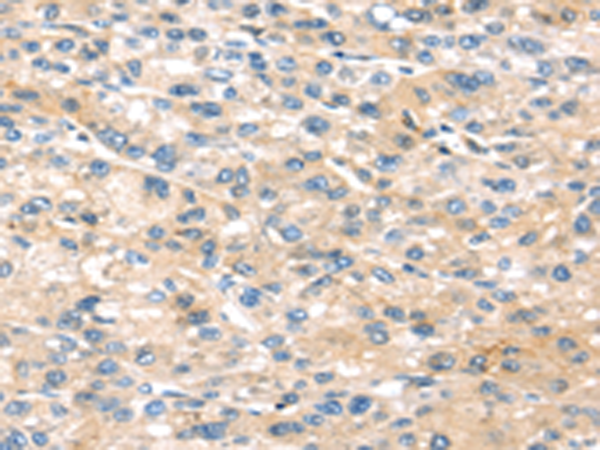 Rabbit Polyclonal Antibody to THBS2