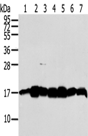 Rabbit Polyclonal Antibody to NME2