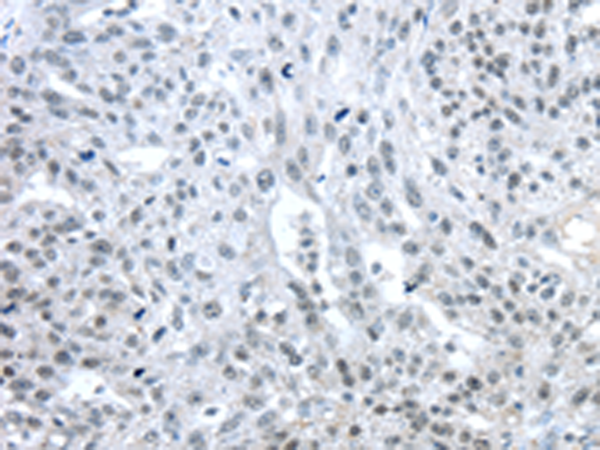 Rabbit Polyclonal Antibody to TRIM33