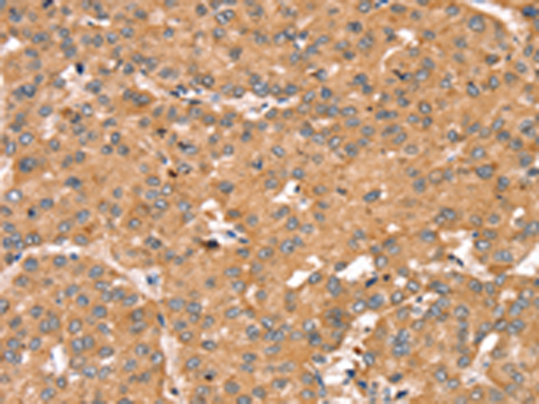 Rabbit Polyclonal Antibody to TRIM14