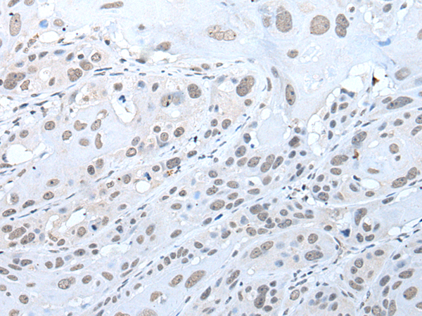 Rabbit Polyclonal Antibody to TRIM23