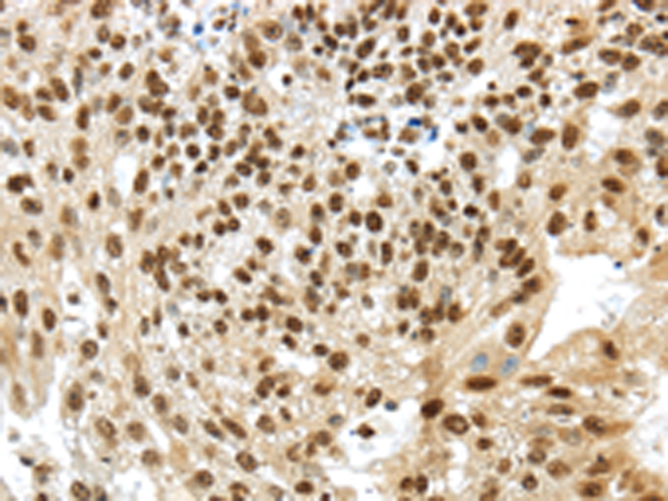 Rabbit Polyclonal Antibody to TRIM27