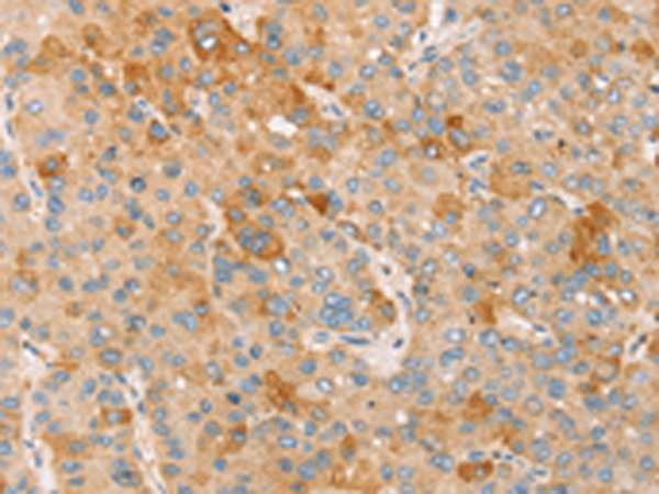 Rabbit Polyclonal Antibody to TRIM25