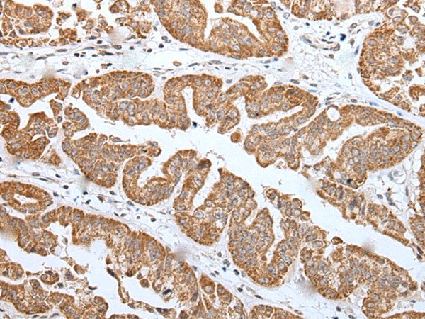 Rabbit Polyclonal Antibody to TRIM71