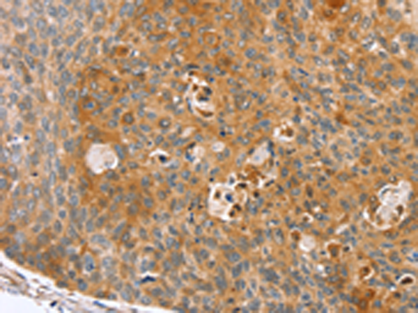 Rabbit Polyclonal Antibody to ZFP36L2
