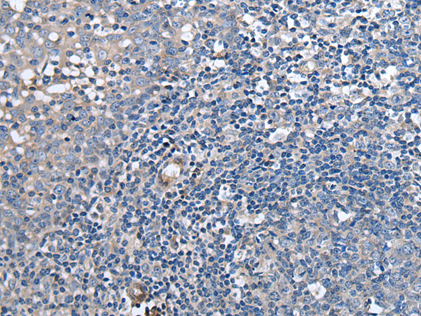 Rabbit Polyclonal Antibody to F3