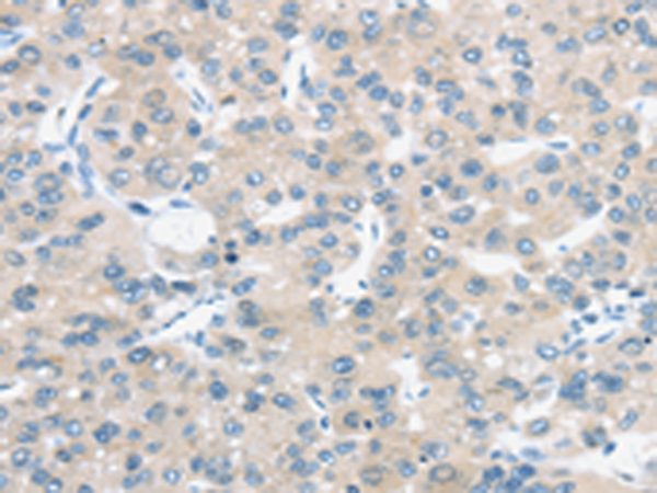 Rabbit Polyclonal Antibody to TM9SF1