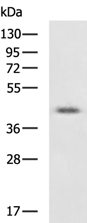 Rabbit Polyclonal Antibody to VMP1