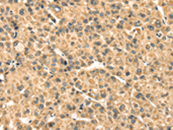 Rabbit Polyclonal Antibody to TMPRSS3