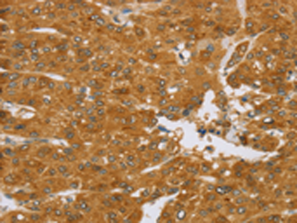 Rabbit Polyclonal Antibody to TNFSF13