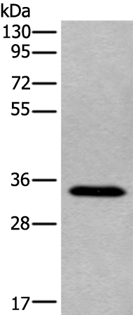 Rabbit Polyclonal Antibody to TNMD