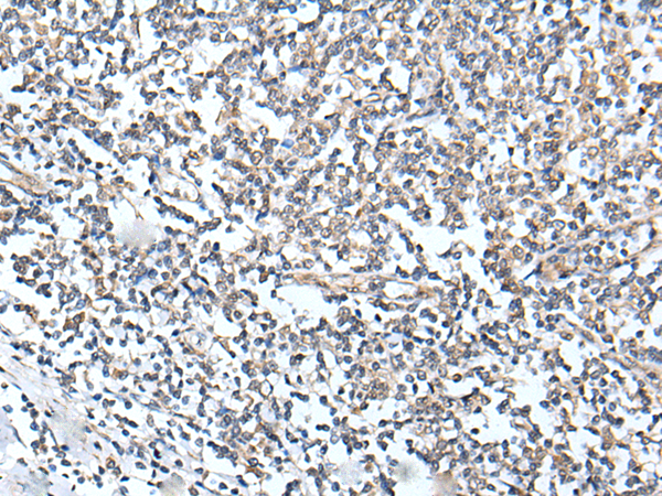 Rabbit Polyclonal Antibody to HUNK