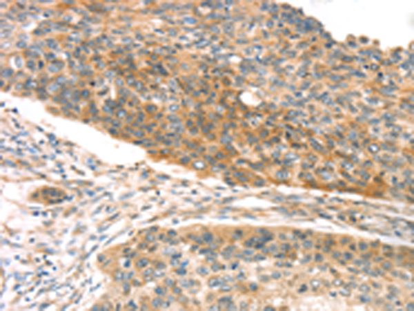 Rabbit Polyclonal Antibody to TPST1