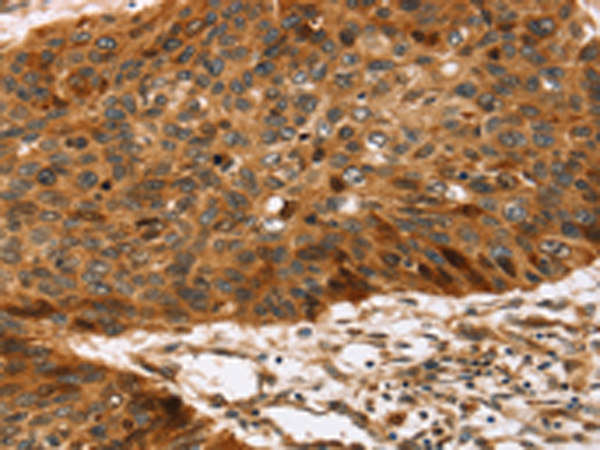 Rabbit Polyclonal Antibody to TPST2