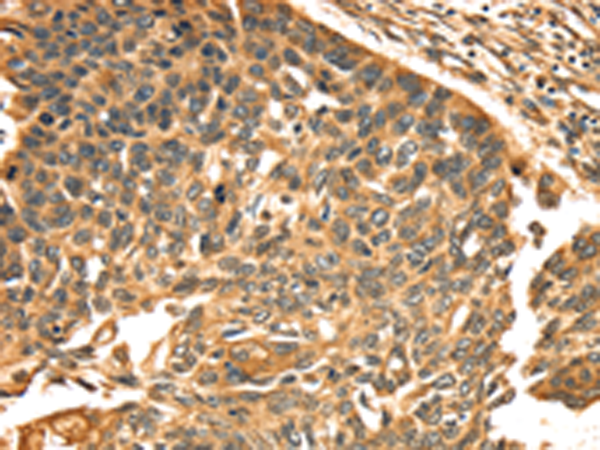 Rabbit Polyclonal Antibody to TGM1