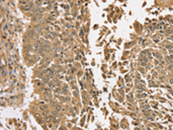 Rabbit Polyclonal Antibody to TGM6