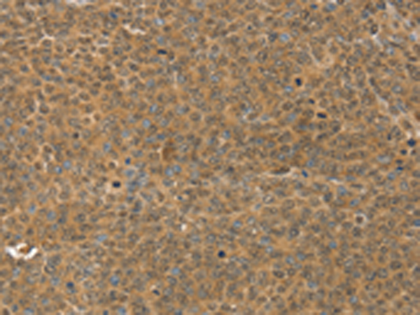 Rabbit Polyclonal Antibody to MED15