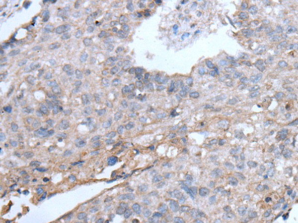 Rabbit Polyclonal Antibody to TRIP11