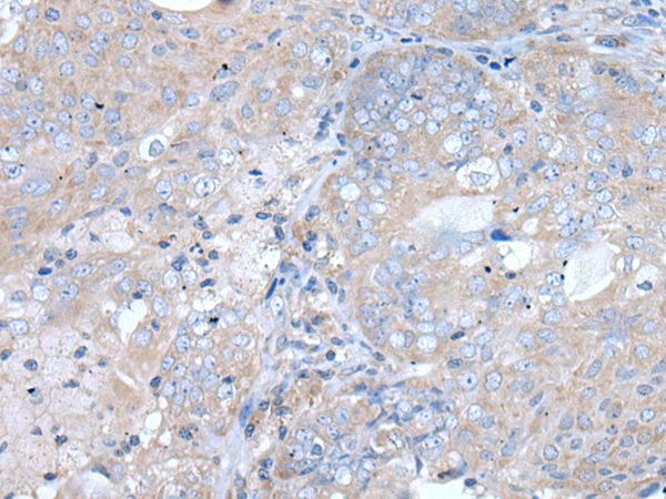 Rabbit Polyclonal Antibody to TRPC5