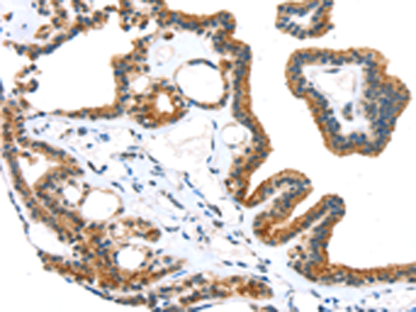 Rabbit Polyclonal Antibody to TRPM6