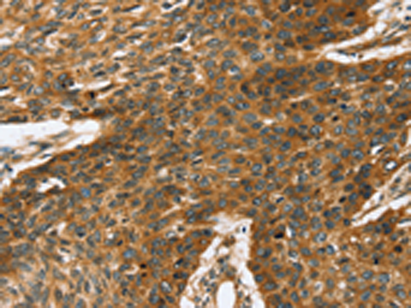 Rabbit Polyclonal Antibody to TRPV5