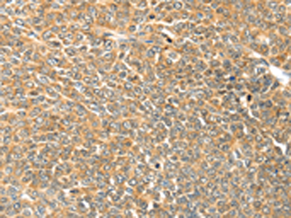Rabbit Polyclonal Antibody to TRPV3