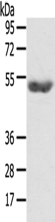 Rabbit Polyclonal Antibody to GPAT4