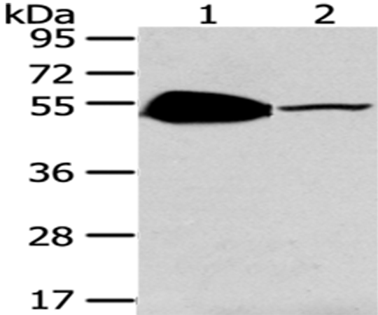 Rabbit Polyclonal Antibody to TSPYL1