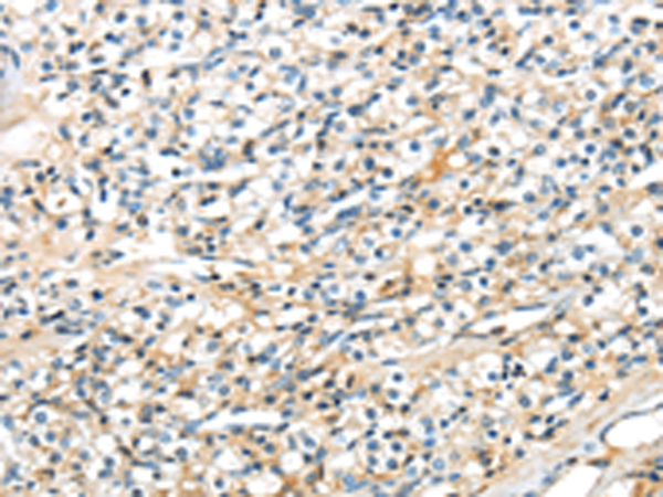 Rabbit Polyclonal Antibody to TSPYL6