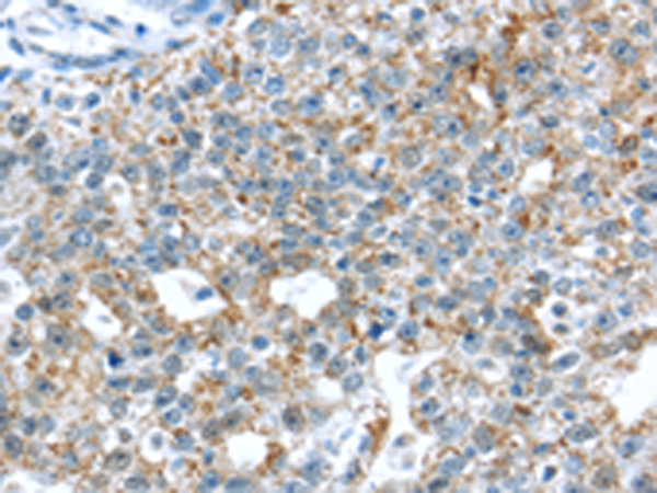Rabbit Polyclonal Antibody to TTBK1