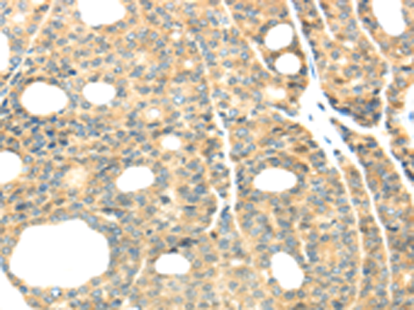 Rabbit Polyclonal Antibody to TTBK2