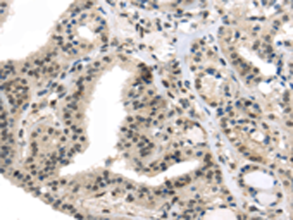 Rabbit Polyclonal Antibody to TRARG1